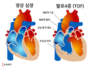 팔로4증.png