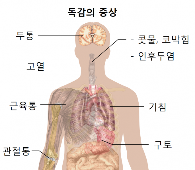 파일:독감증상.png