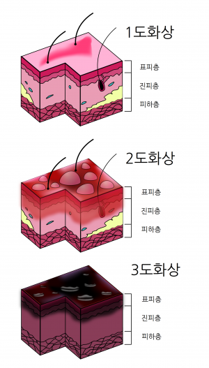 화상분류.png