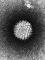 인유두종바이러스.jpg
